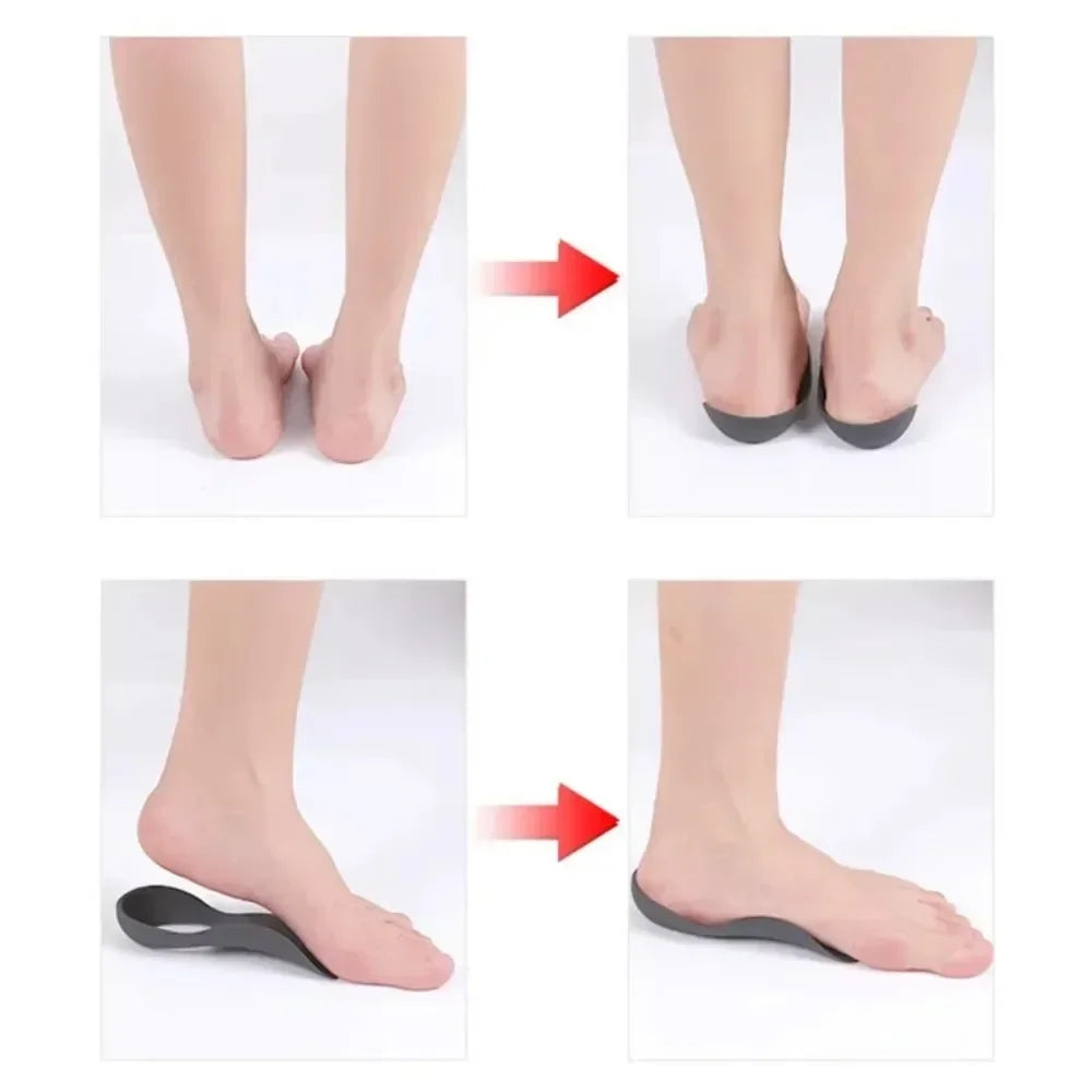 Arch Support Insoles (1 Pair)